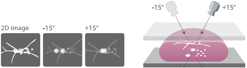 Stereo imaging Image