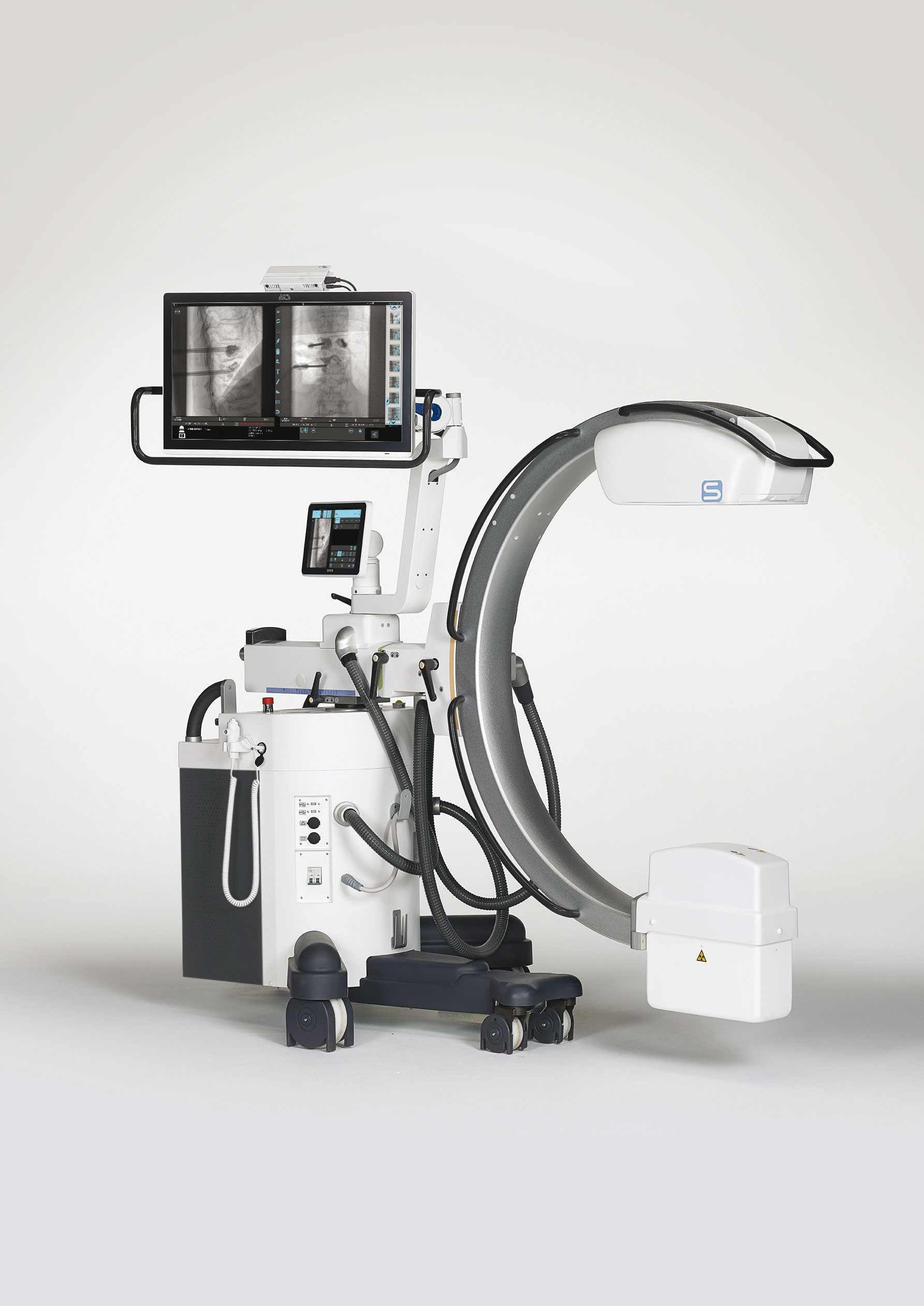 Single unit powerful mobile fluoroscopy system, with high image resolution in surgical applications Image